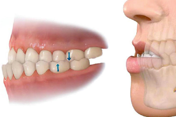cirugía maxilofacial