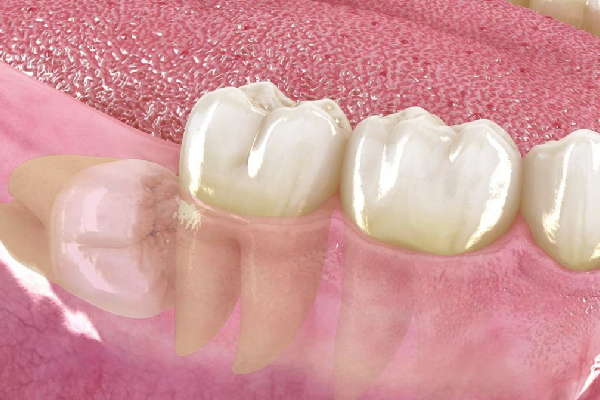 cirugía maxilofacial